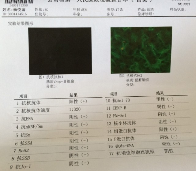 2014.5抗核抗体