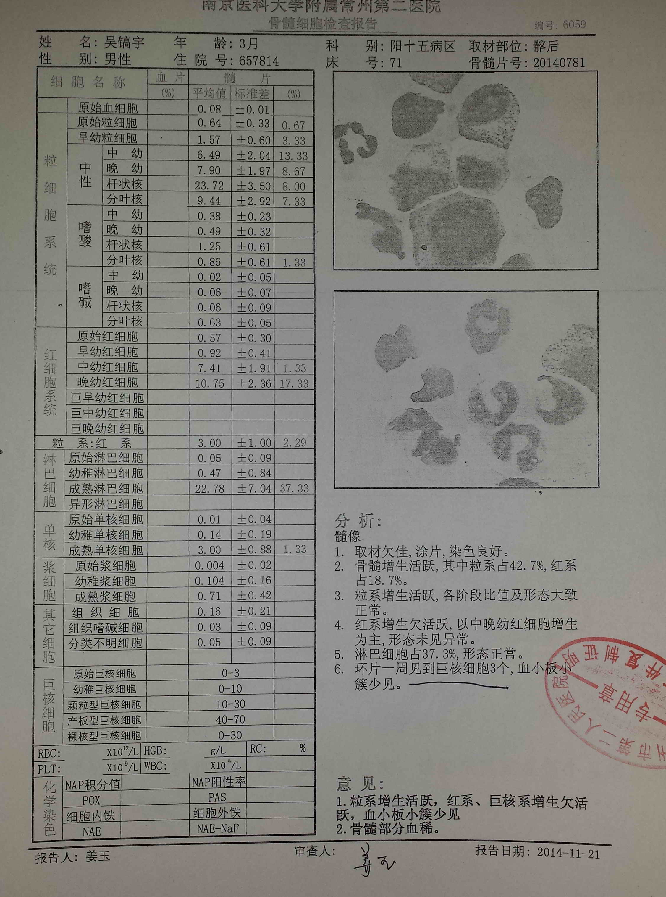 骨穿报告.jpg