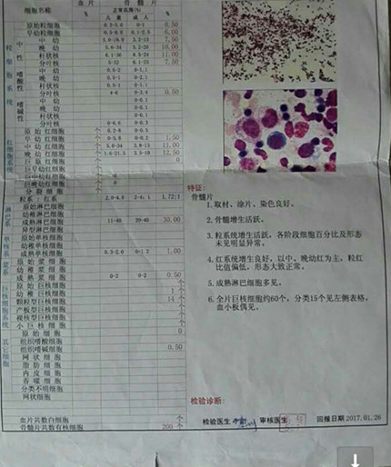 骨穿报告