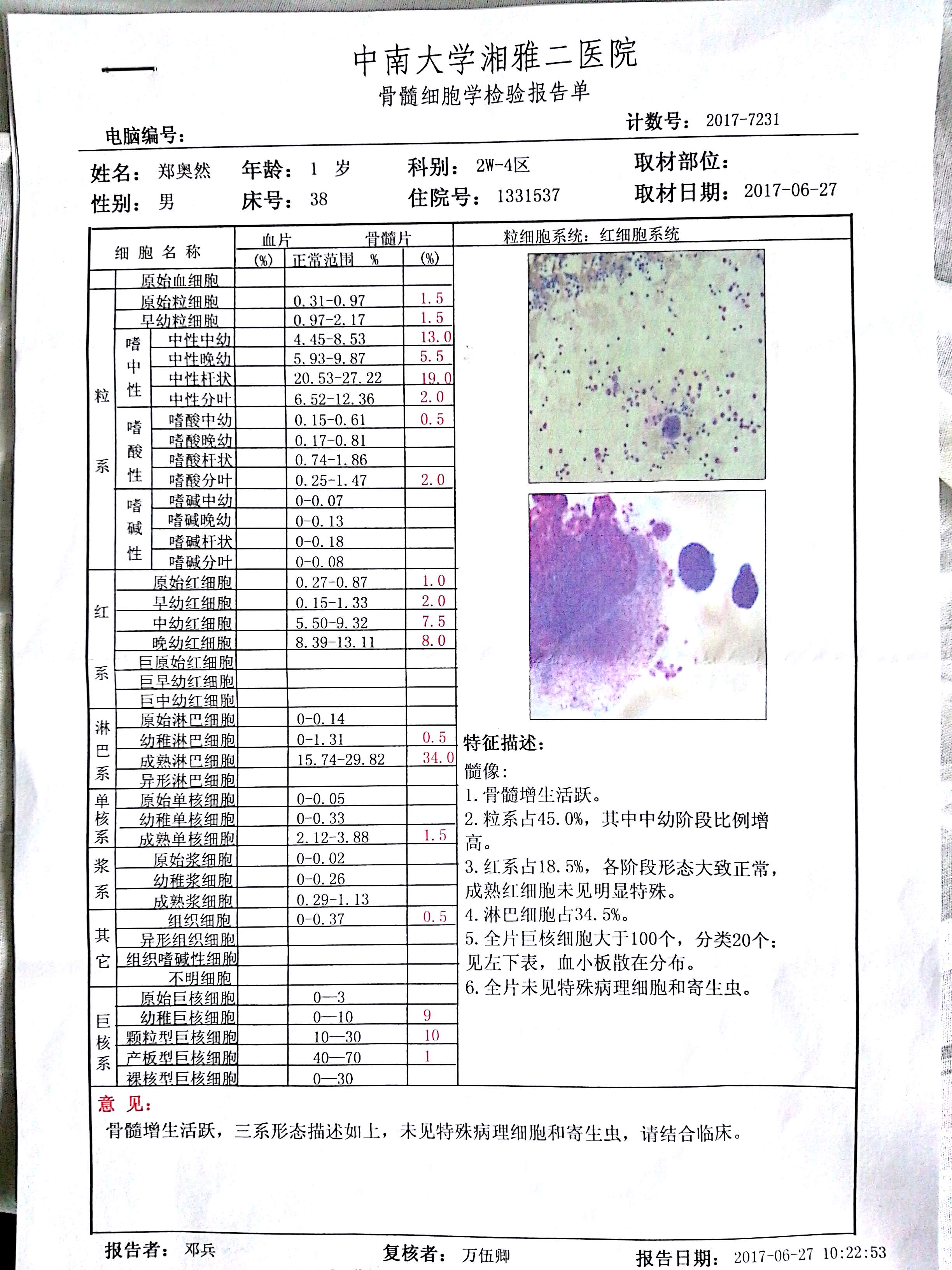 2017入院时骨穿1