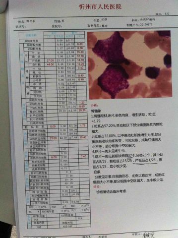 骨穿