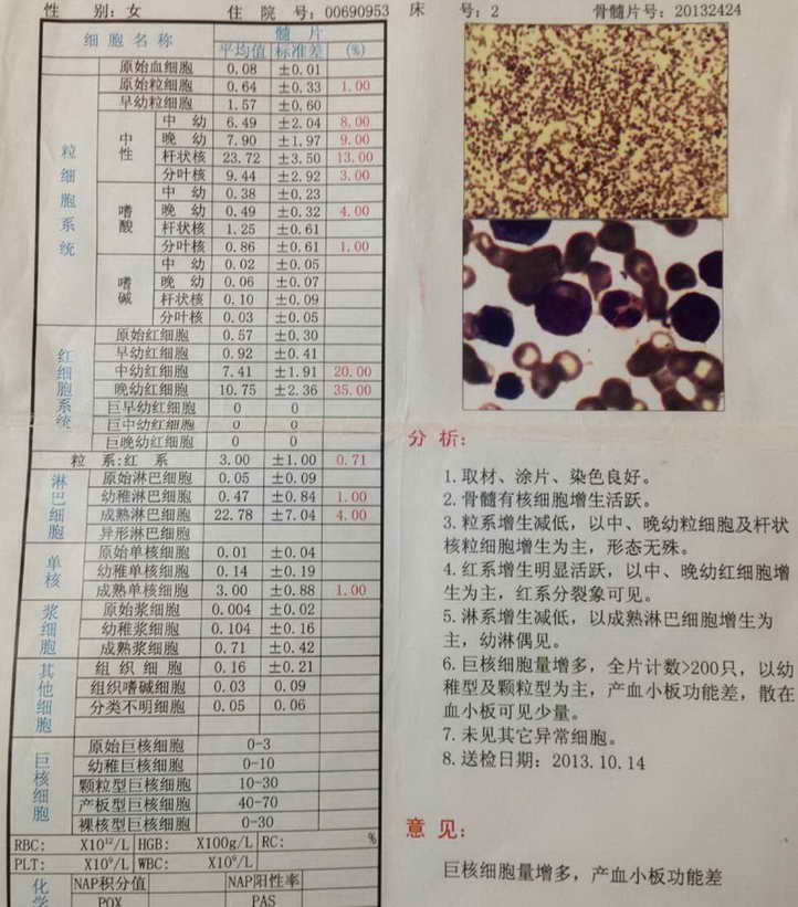 骨髓报告.jpg