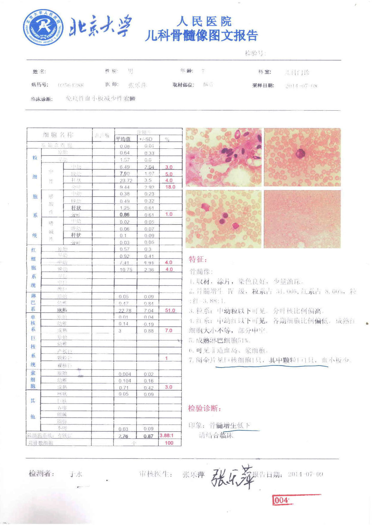 骨髓像图文.jpg