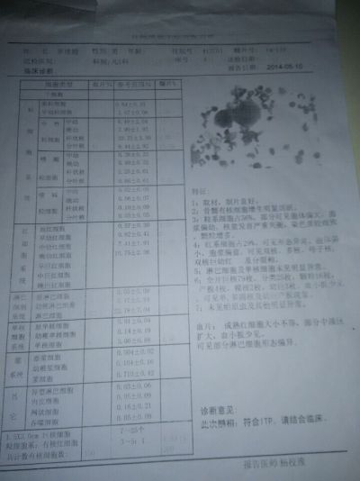 骨穿