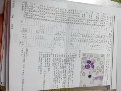 骨穿报告单