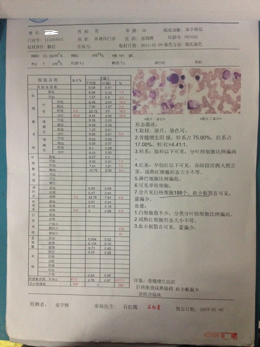 骨穿
