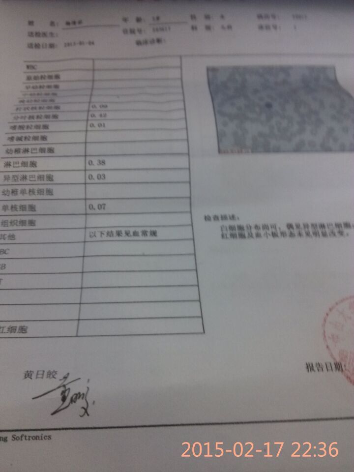 血象分析