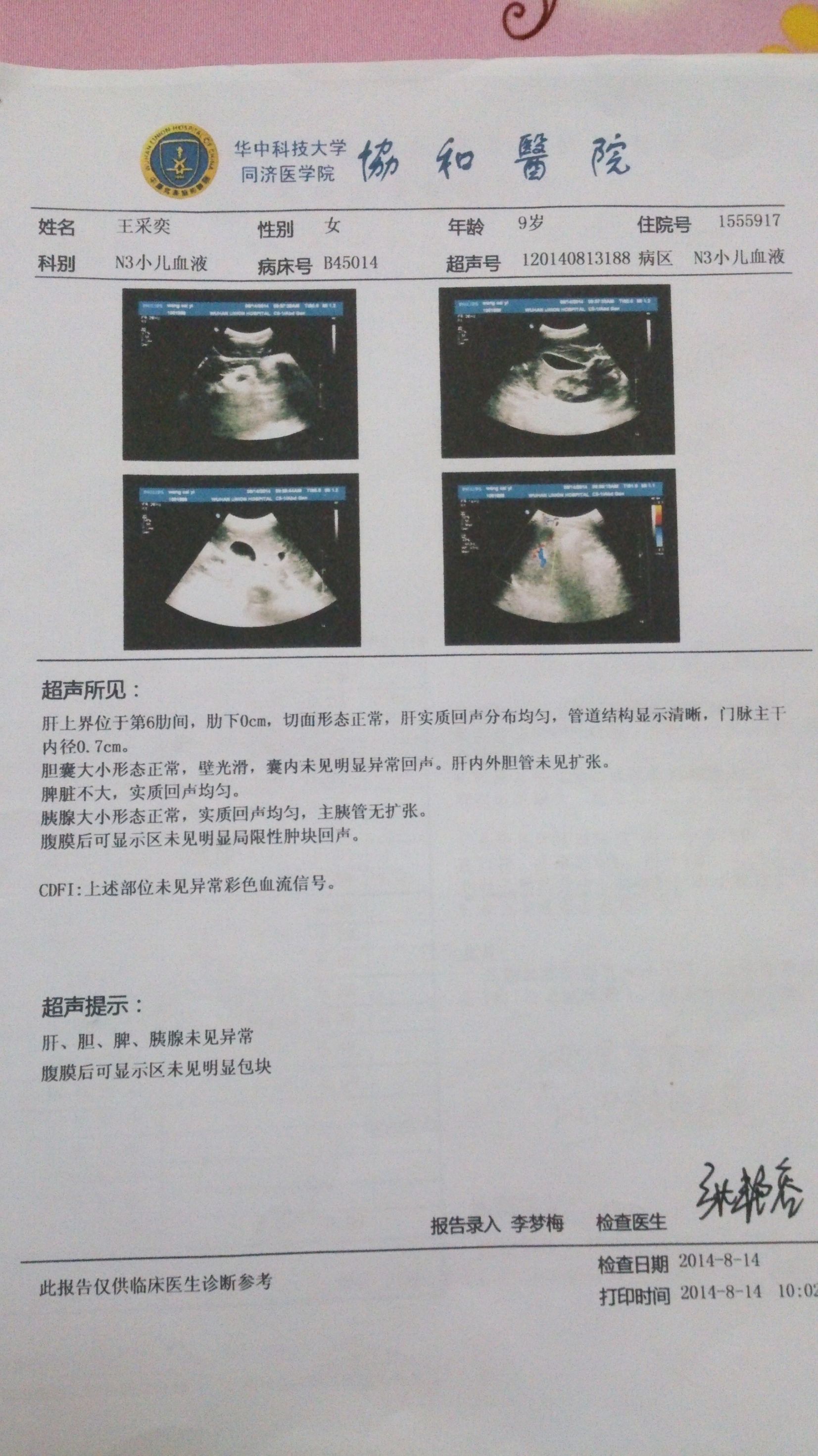8月14号B超