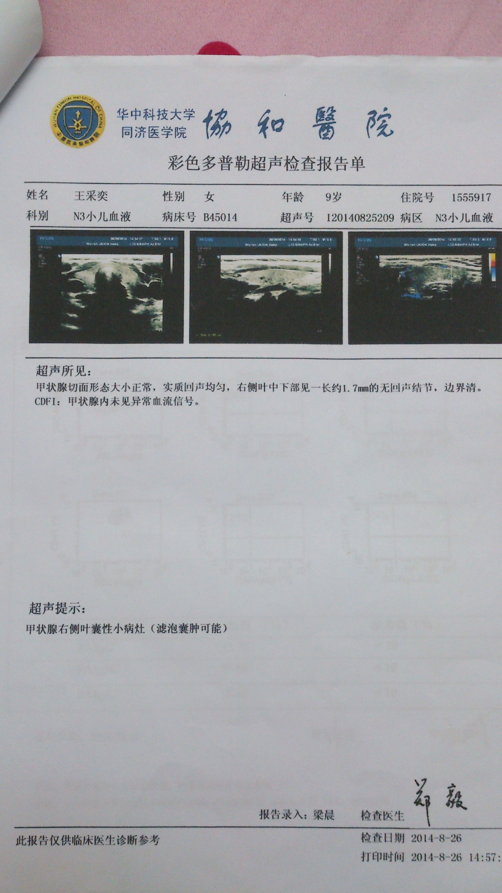 8月26号B超甲状腺..JPG