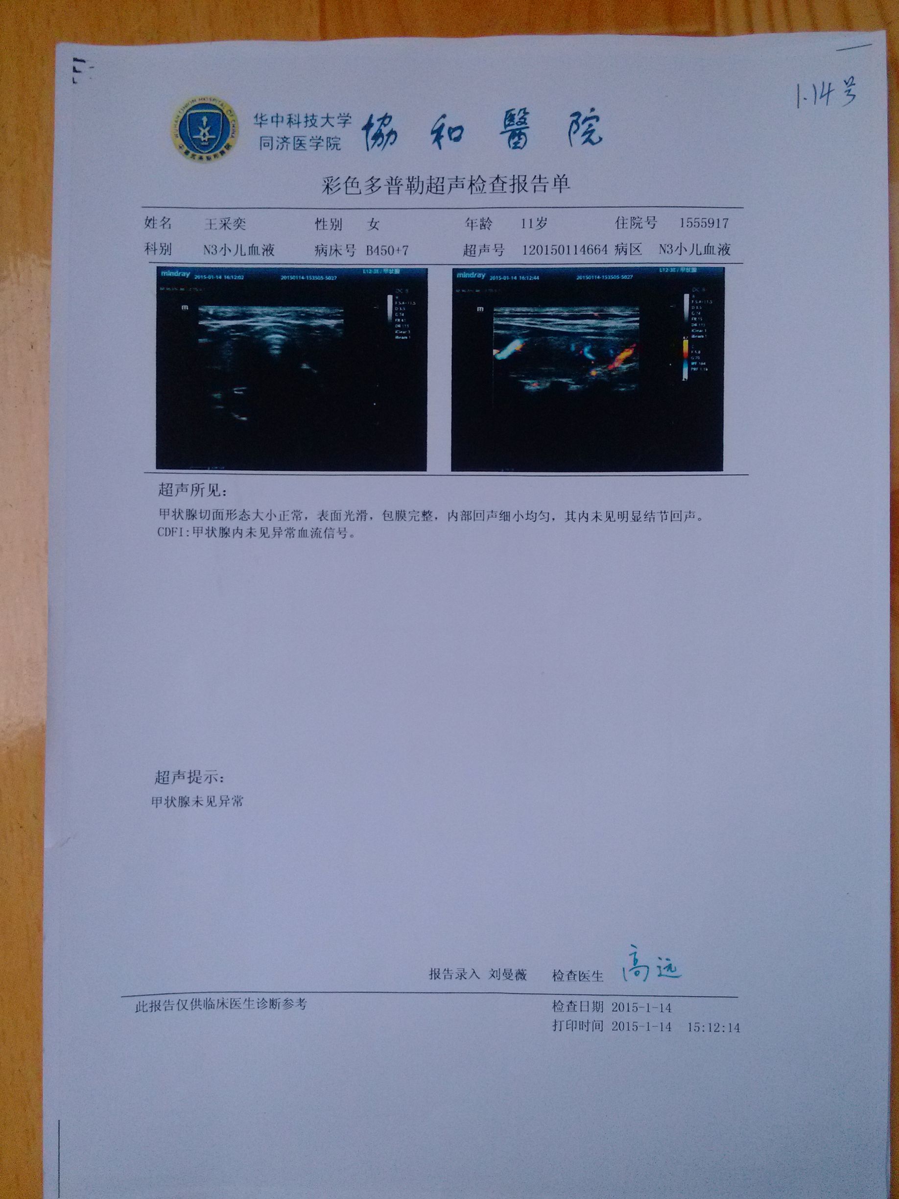 15年1月14号甲状腺B超