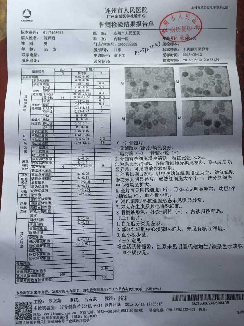 骨穿检查