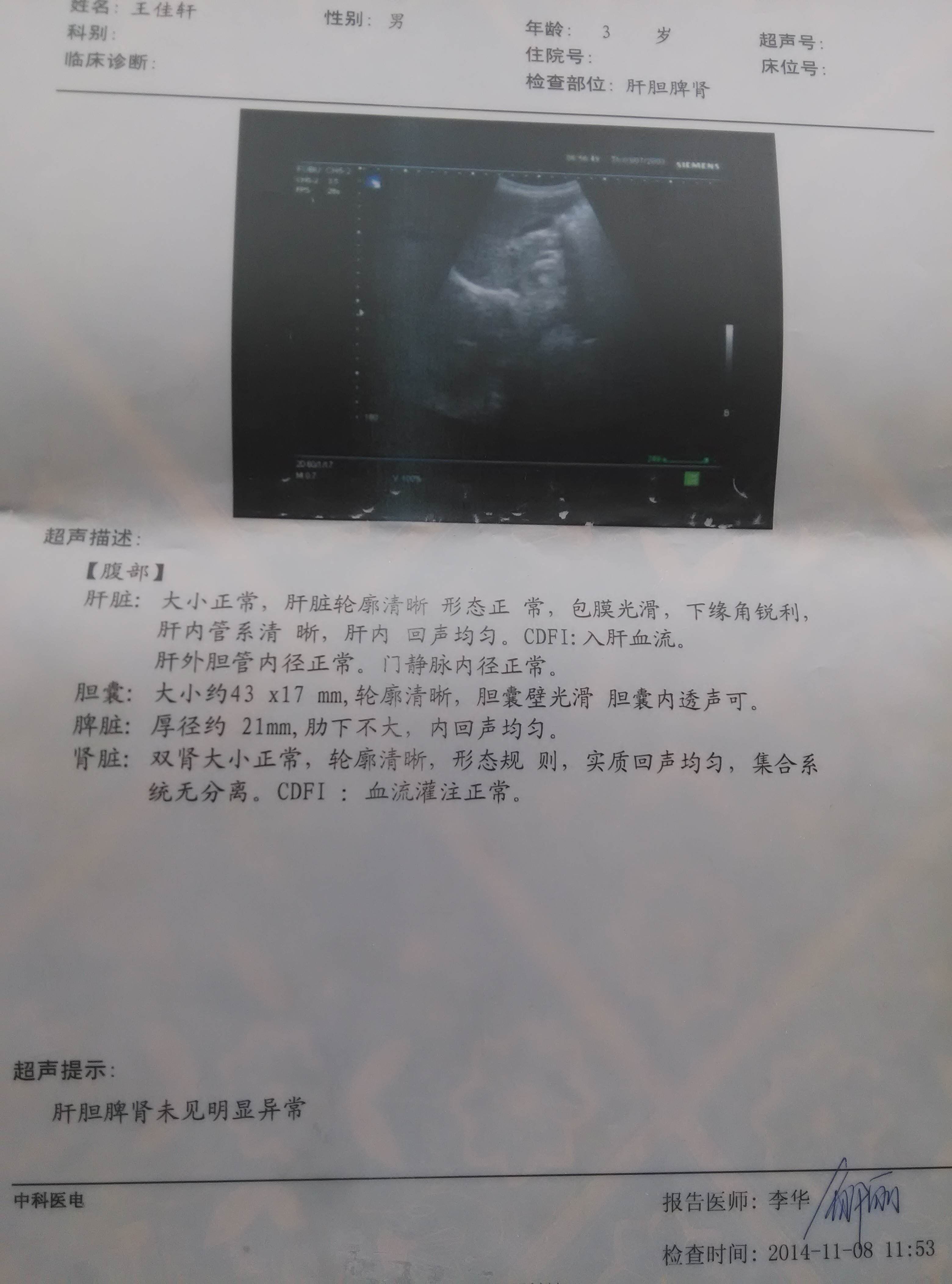 肝胆脾肾检查