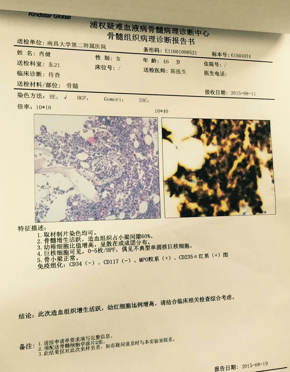 骨髓组织病理诊断报告20150819.jpg