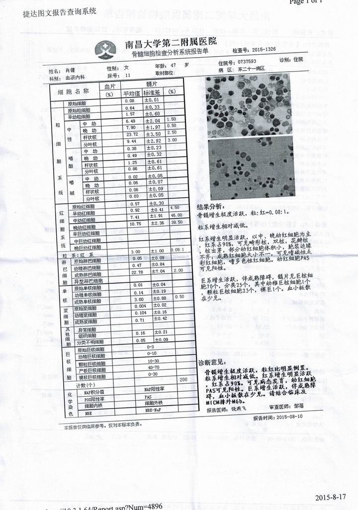 调整大小 骨髓细胞检查分析报告20150817.jpg