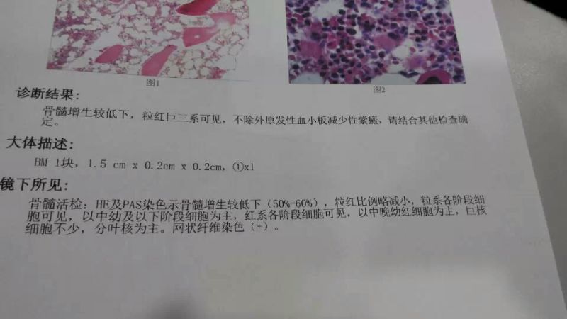 2ee93be552b5b41c63e08b4b1cb3592b_.jpg