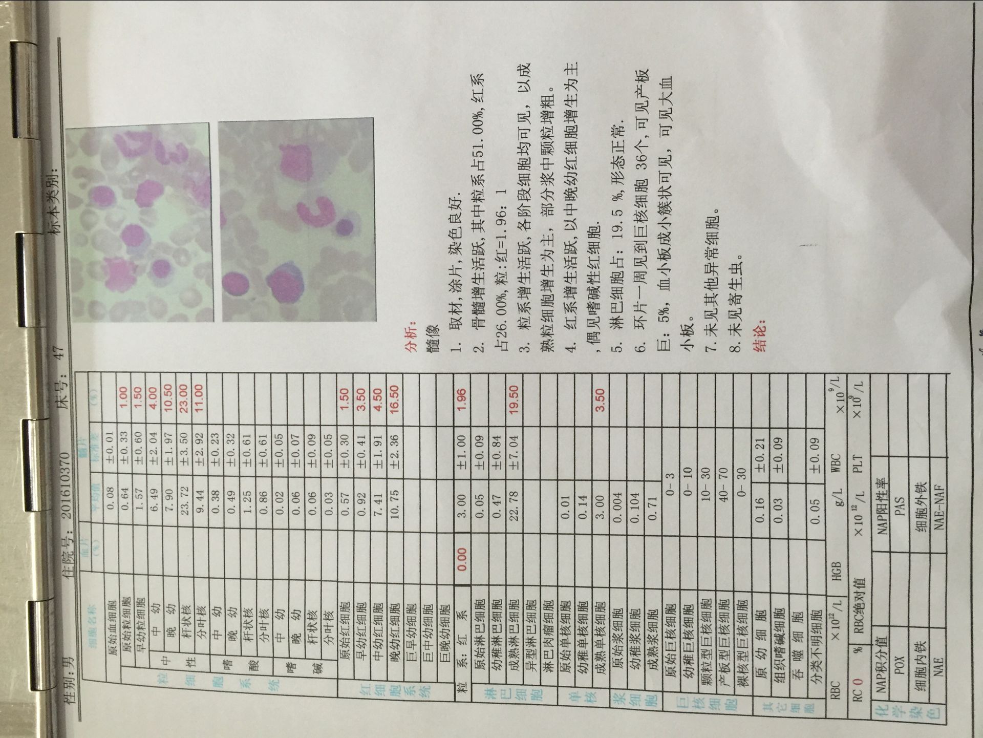 骨穿结果
