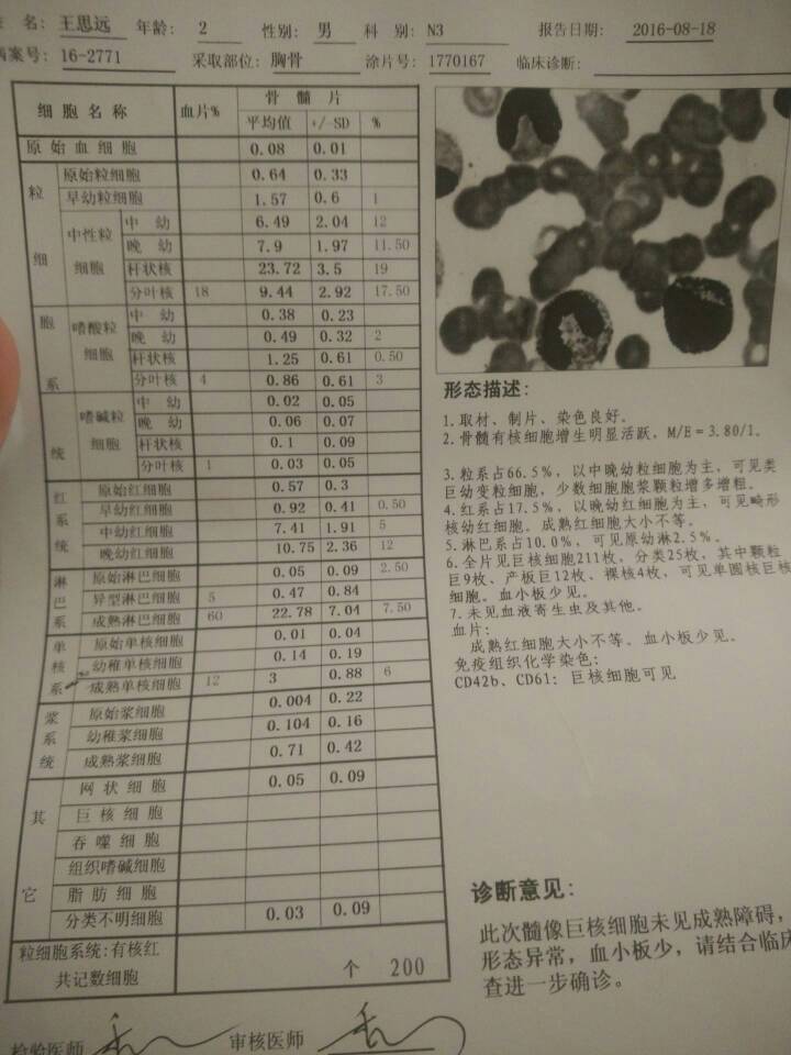 145420u0mftm0md0fw0cwc.jpg