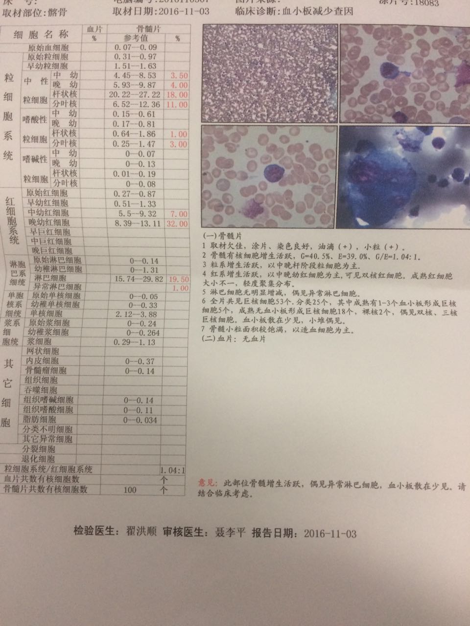 骨髓穿刺