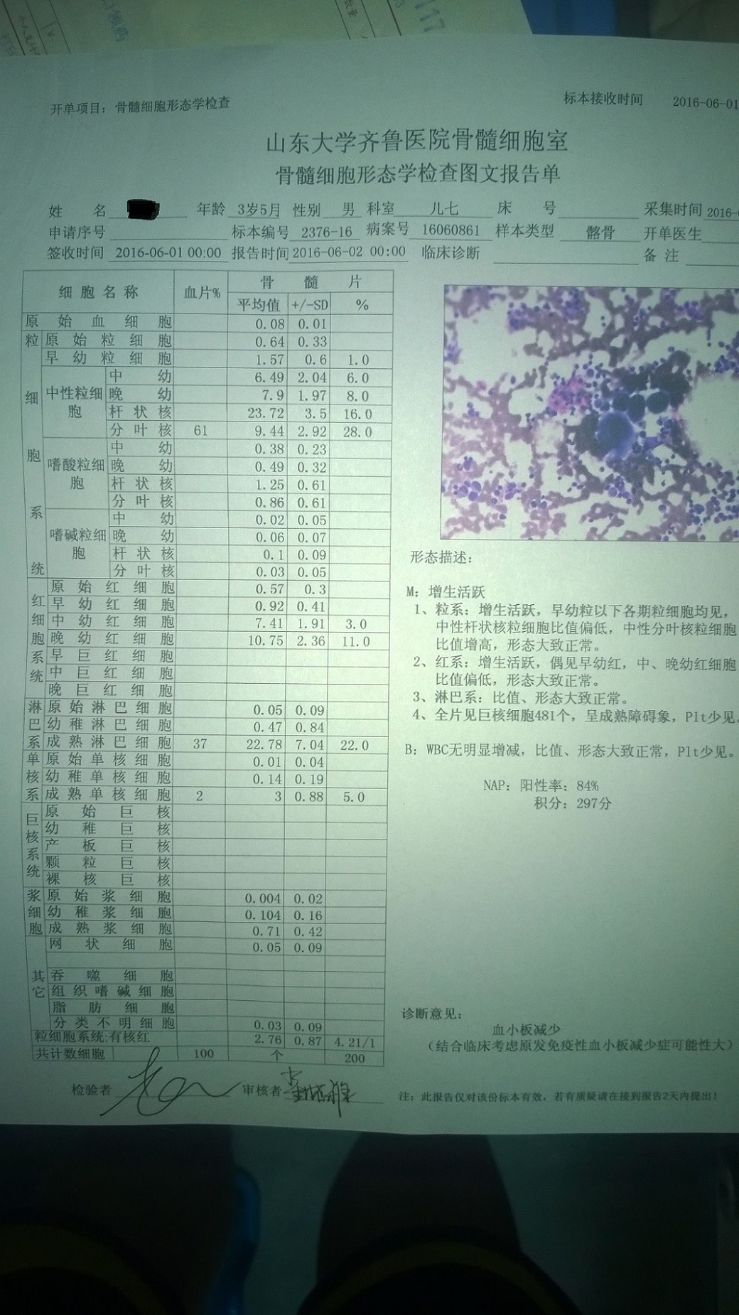 齐鲁医院骨穿报告.JPG