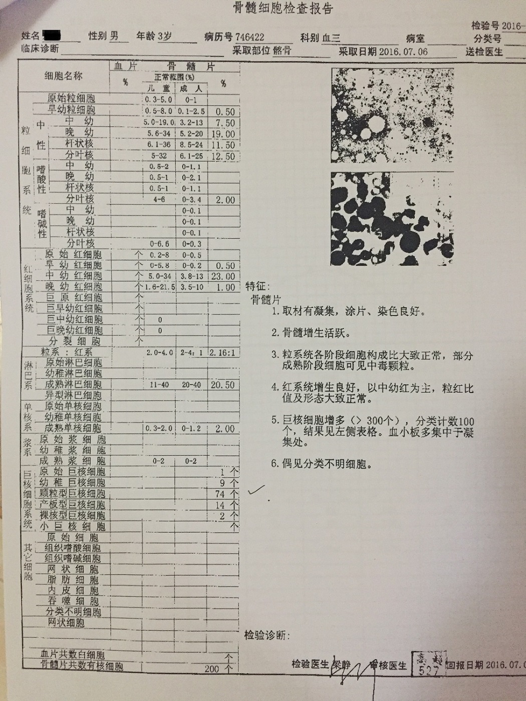 北儿骨穿报告