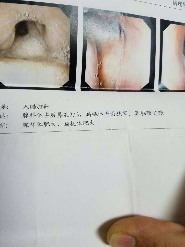 155356qcgobcg8pq6nq5zy.jpg