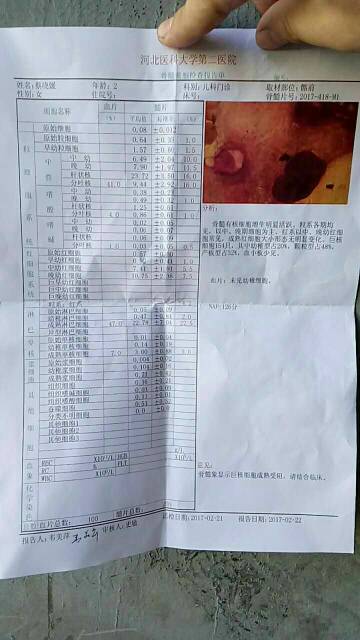 170202e56tp6p6zi2k3kke.jpg