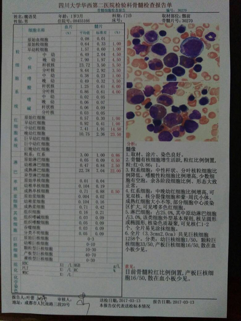 202335h94d2mdtts24ad45.jpg
