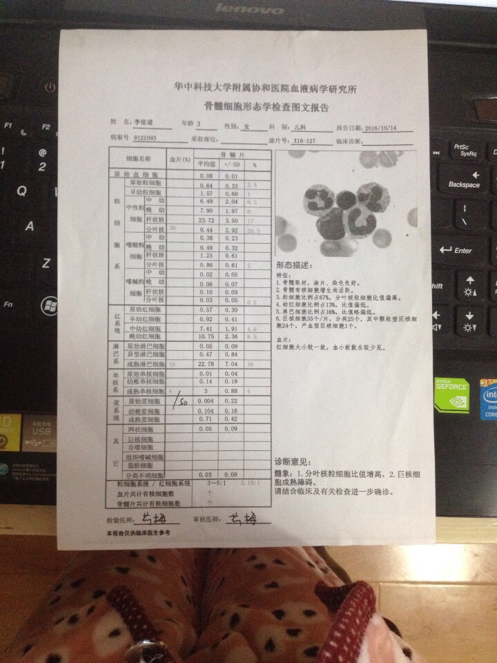 011442bxf81fyobolvx31s.jpg
