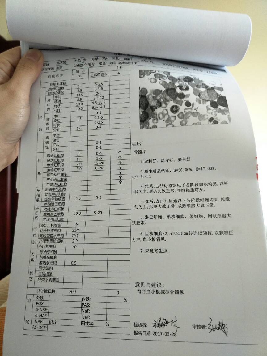 222104ta3xn5wx3k5gh2y3.jpg