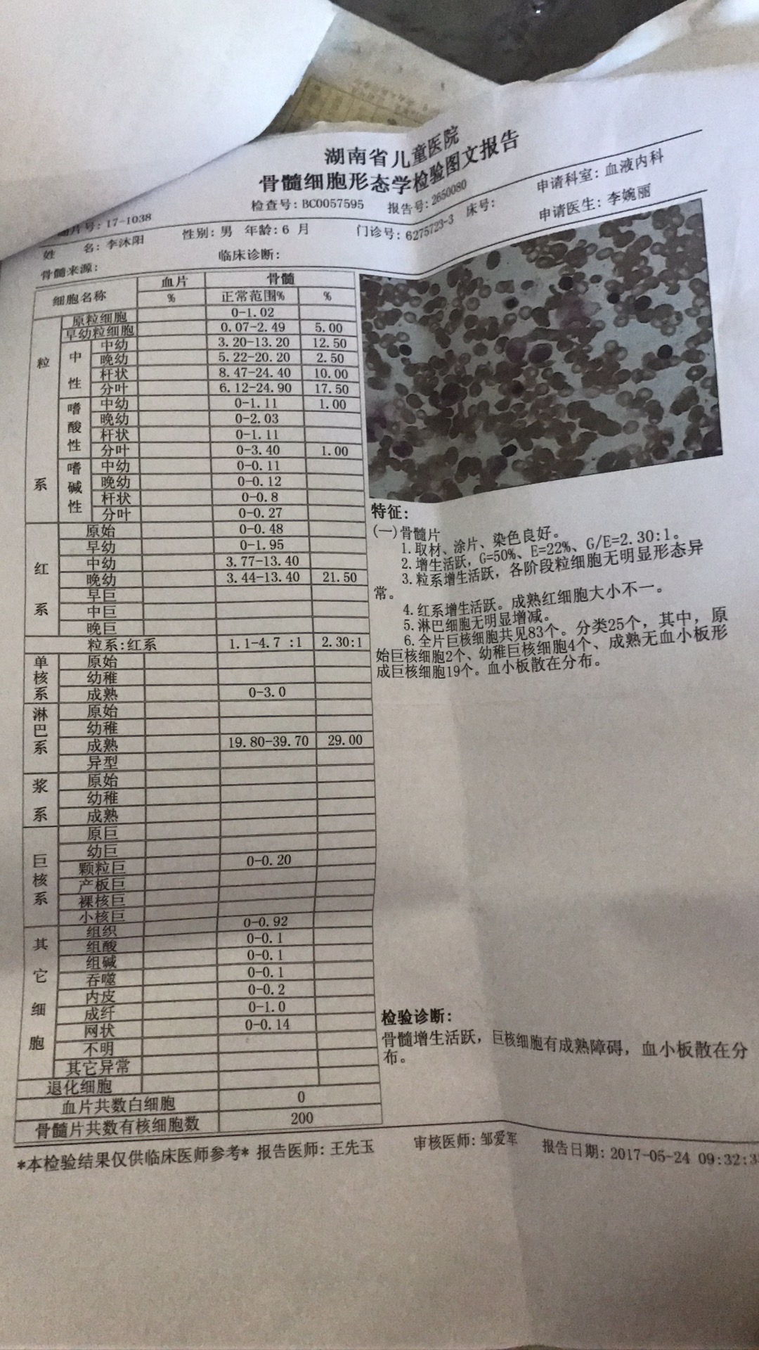 骨穿结果