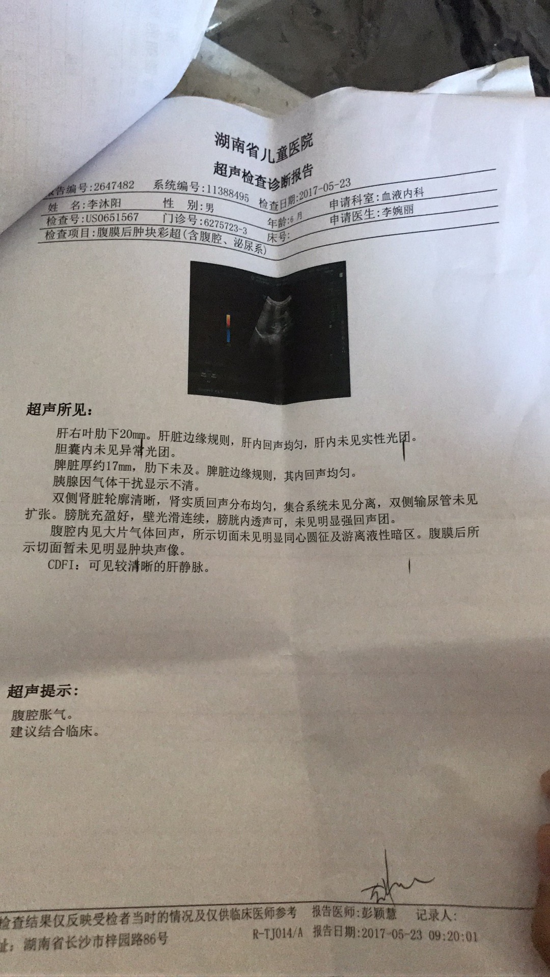 彩超检查结果