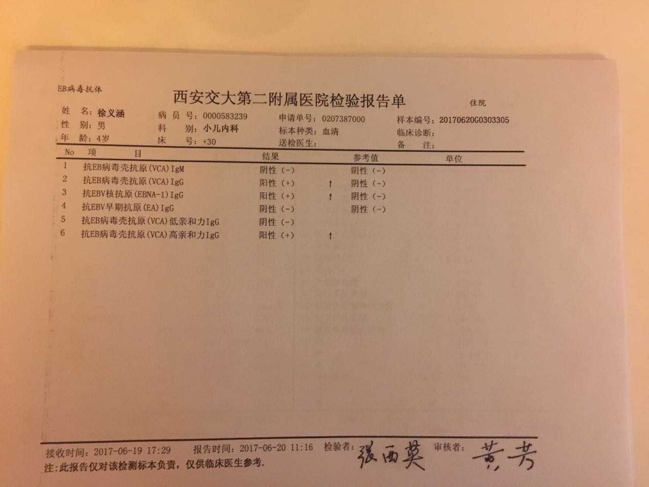 EB病毒1