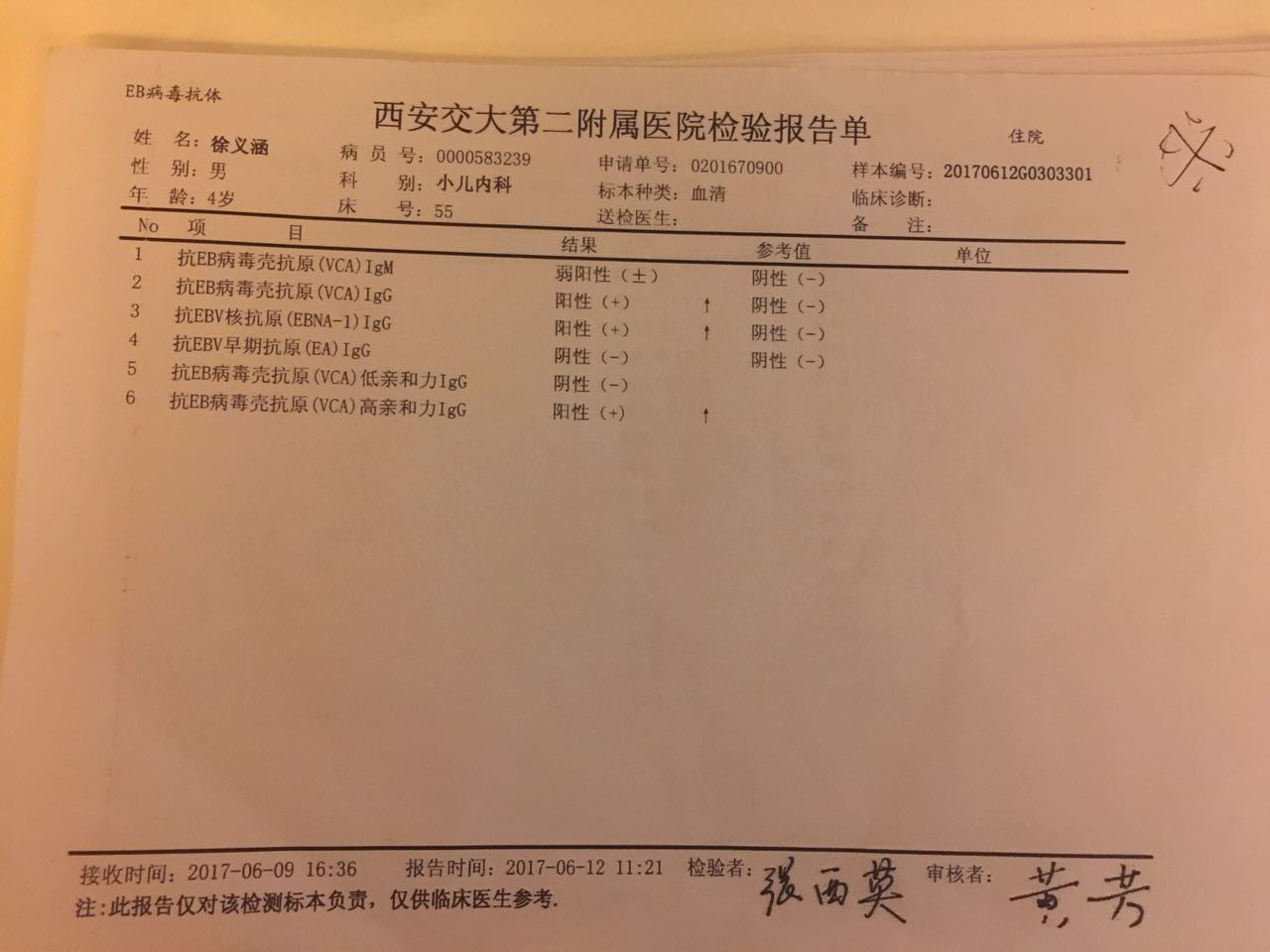 EB病毒2