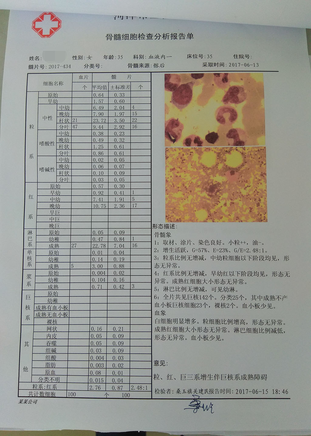 0613骨髓细胞检查分析报告.jpg