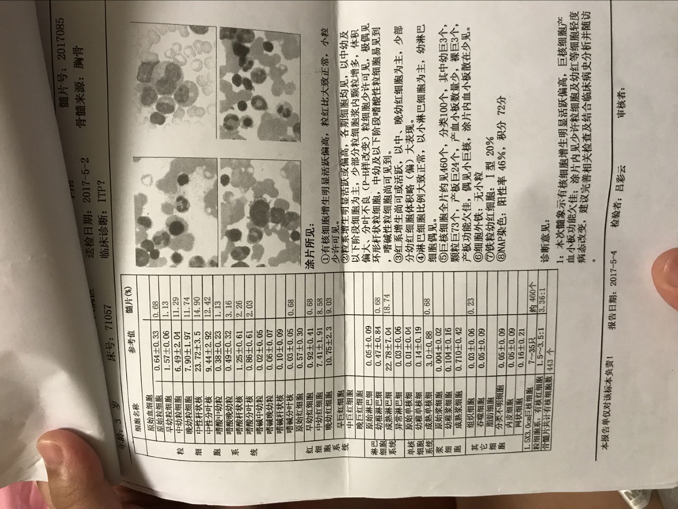 骨穿报告