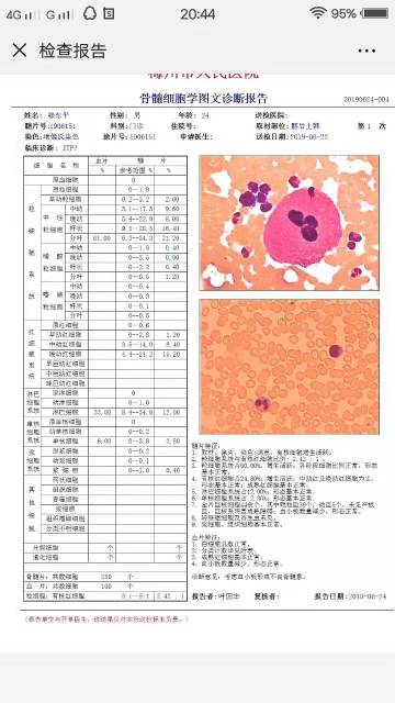 233308ctochty2cm3teeoc.jpg