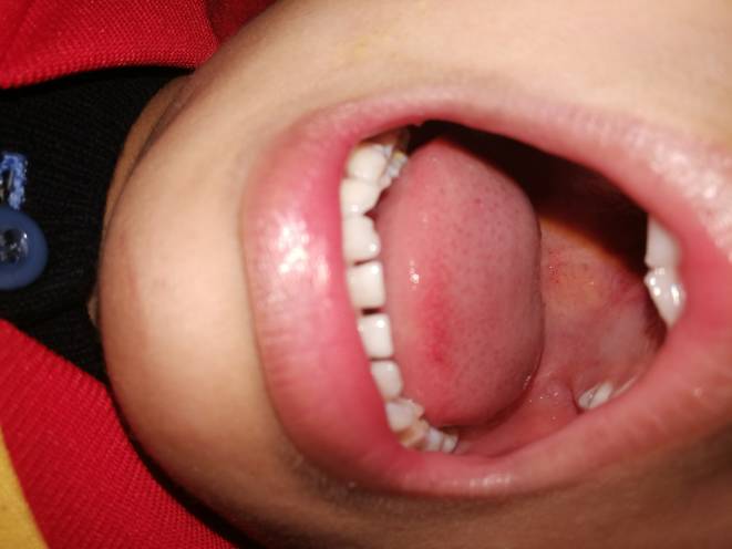 203802pn9i8w6hzpsfaprf.jpg