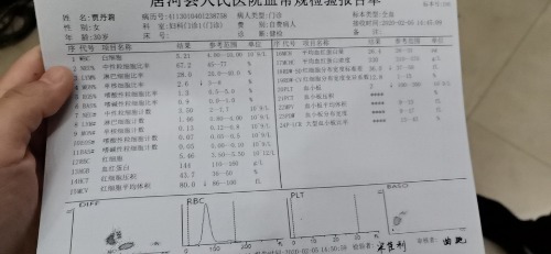 wx_camera_1580885824930.jpg