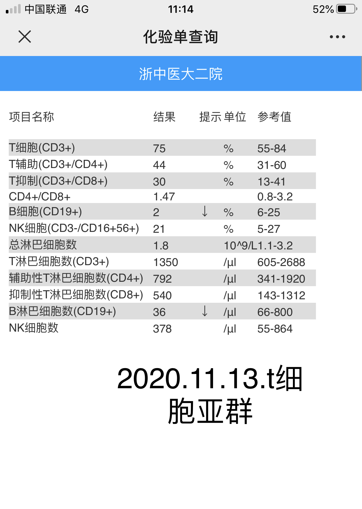 170128wgw4pbz84v4n44gn.jpeg